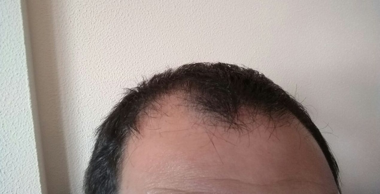 Cuanto Tarda En Crecer El Pelo De Un Perro Rapado