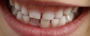 Dientes